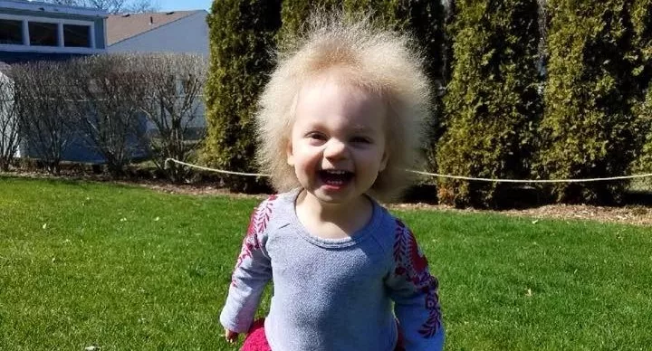 Волосы этой малышки невозможно уложить и ее называют «Эйнштейн 2.0»