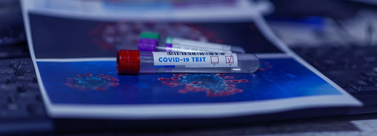 Когда закончится пандемия коронавируса в США: прогноз CDC